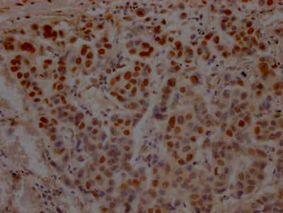 TP53 Recombinant Monoclonal Antibody