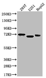 SLC6A4 Recombinant Monoclonal Antibody