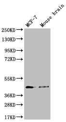SLC27A4 Recombinant Monoclonal Antibody