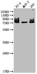 MEN1 Recombinant Monoclonal Antibody