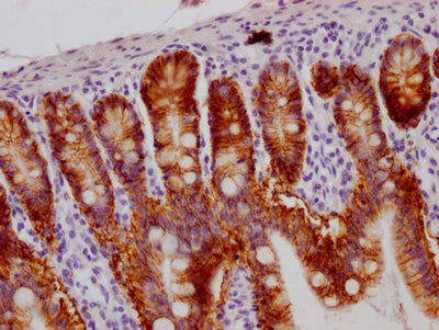 GPA33 Recombinant Monoclonal Antibody