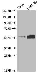 NUF2 Recombinant Monoclonal Antibody