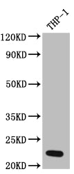 IL23A Recombinant Monoclonal Antibody
