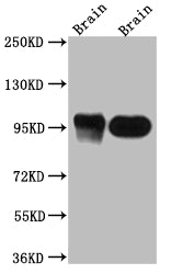 DLG4 Recombinant Monoclonal Antibody