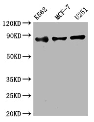 IKBKB Recombinant Monoclonal Antibody