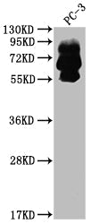 PCSK9 Recombinant Monoclonal Antibody