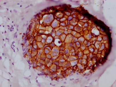 ERBB2 Recombinant Monoclonal Antibody