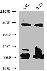 BUB1B Recombinant Monoclonal Antibody