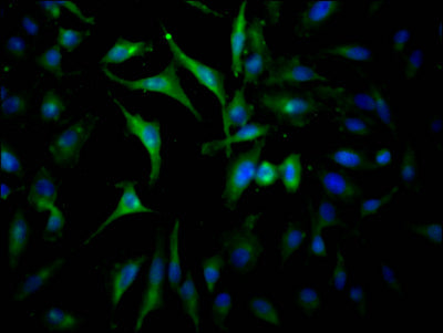 JAK2 Recombinant Monoclonal Antibody