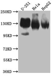 ITGAV Recombinant Monoclonal Antibody