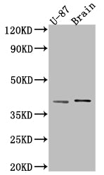 NGF Recombinant Monoclonal Antibody