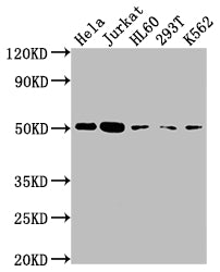 CASP2 Recombinant Monoclonal Antibody