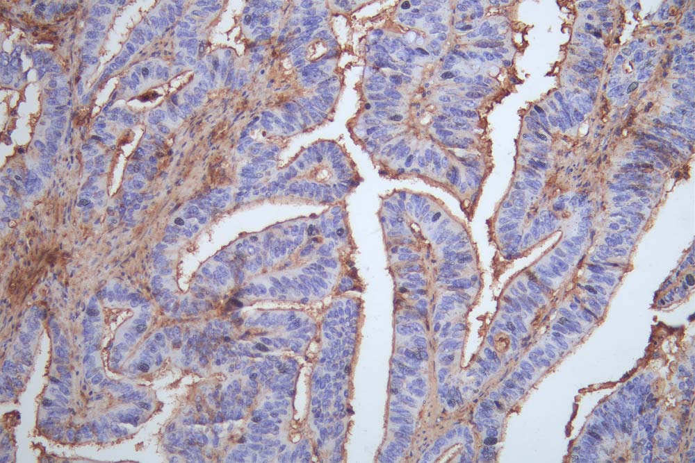 OCLN Recombinant Monoclonal Antibody