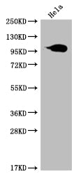 ACO1 Recombinant Monoclonal Antibody