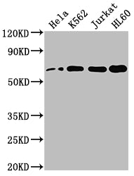 HDAC1 Recombinant Monoclonal Antibody