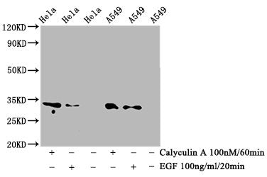 Phospho-CDK1/CDK2/CDK3 (T14) Recombinant Monoclonal Antibody