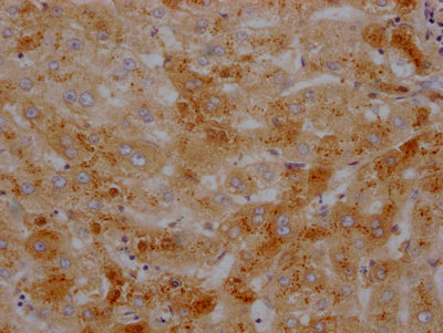 TTR Recombinant Monoclonal Antibody