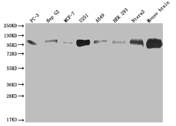 ALCAM Recombinant Monoclonal Antibody