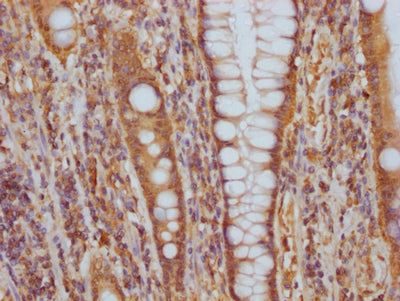 ITGAV Antibody