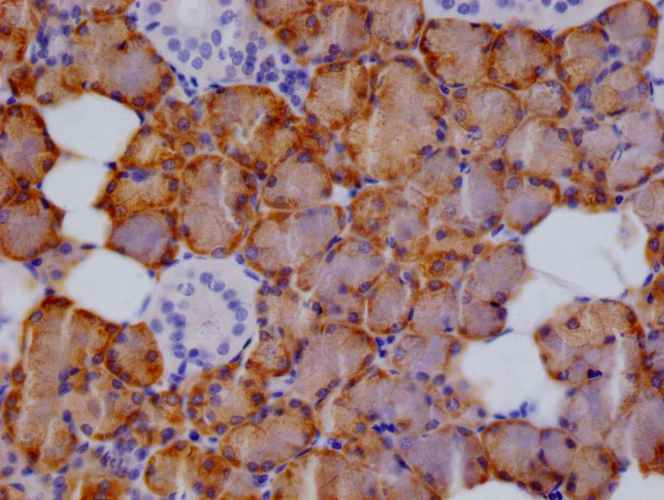 CTPS1 Recombinant Monoclonal Antibody
