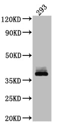 DKK1 Recombinant Monoclonal Antibody