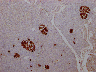 INS Recombinant Monoclonal Antibody
