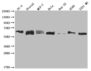 USP14 Recombinant Monoclonal Antibody