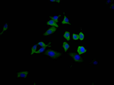 TP53 Recombinant Monoclonal Antibody