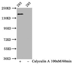 Phospho-SMC1A (S957) Recombinant Monoclonal Antibody