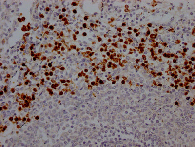 MPO Recombinant Monoclonal Antibody
