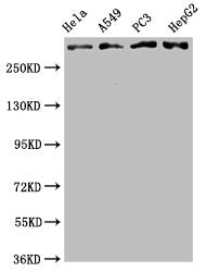 ATM Recombinant Monoclonal Antibody