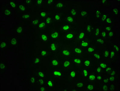 Phospho-ATM (S1981) Recombinant Monoclonal Antibody