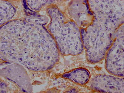 TPBG Antibody