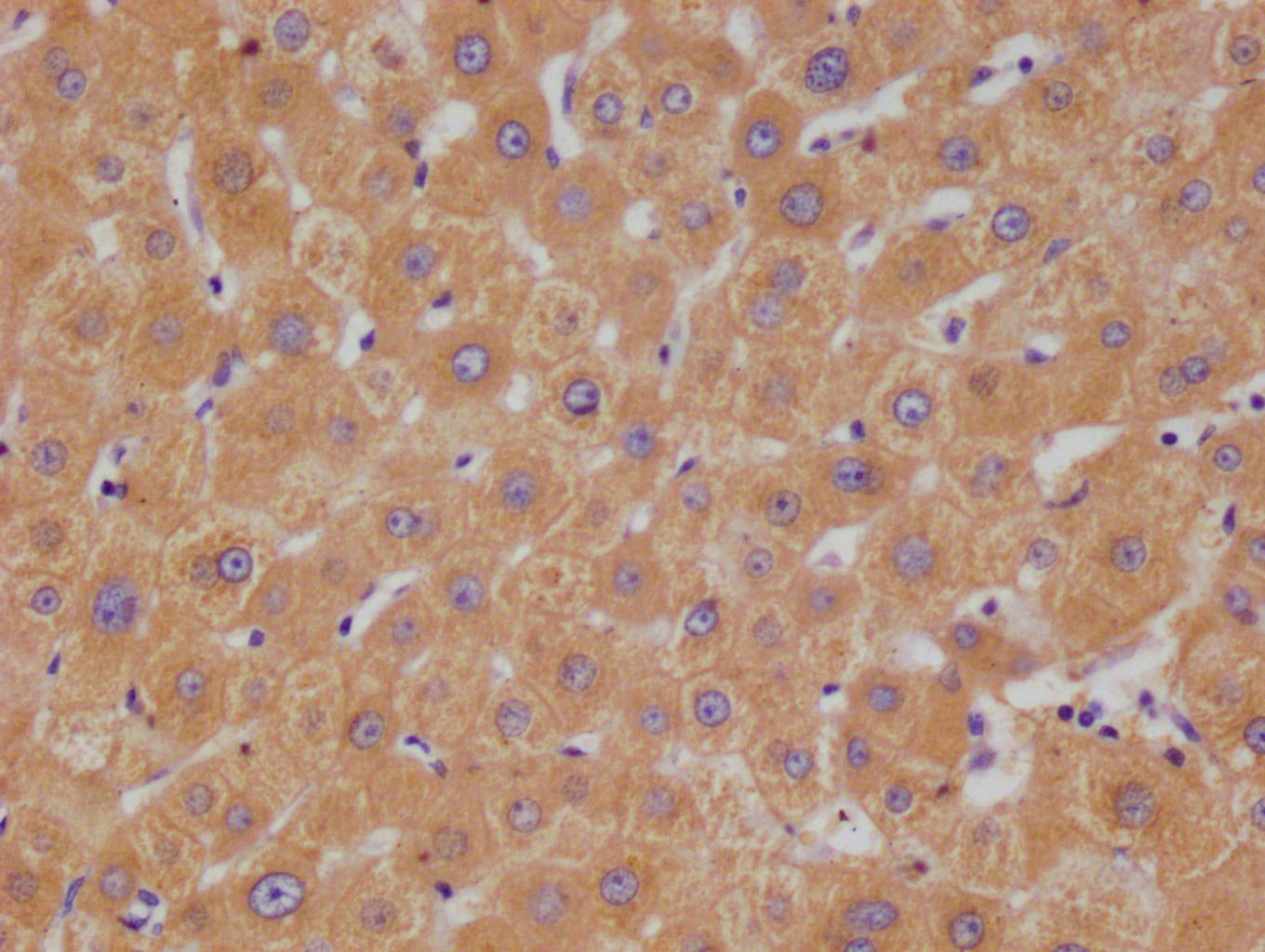 HGD Recombinant Monoclonal Antibody
