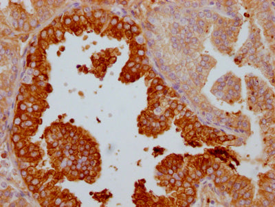 LTF Recombinant Monoclonal Antibody
