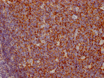 CR1 Recombinant Monoclonal Antibody