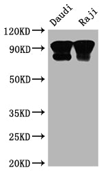 CD19 Recombinant Monoclonal Antibody