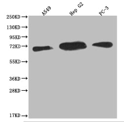 USP22 Recombinant Monoclonal Antibody
