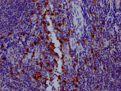 GZMB Recombinant Monoclonal Antibody