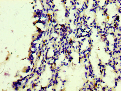 CD163 Recombinant Monoclonal Antibody
