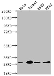 YWHAG Recombinant Monoclonal Antibody