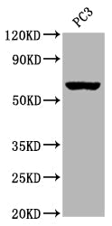 CHRM3 Recombinant Monoclonal Antibody