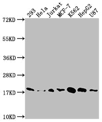 SOD1 Recombinant Monoclonal Antibody