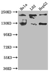 MGEA5 Recombinant Monoclonal Antibody