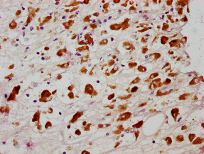 Phospho-MLKL (S358) Recombinant Monoclonal Antibody