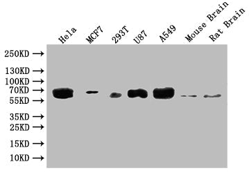 GBA Recombinant Monoclonal Antibody