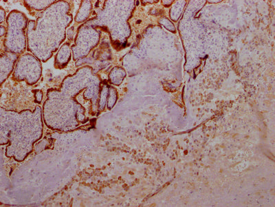 GH1 Recombinant Monoclonal Antibody