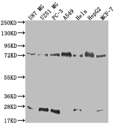 CAPN2 Recombinant Monoclonal Antibody