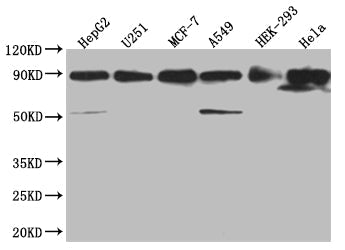HSP90AB1 Recombinant Monoclonal Antibody