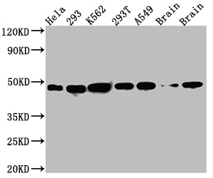 NUDC Recombinant Monoclonal Antibody
